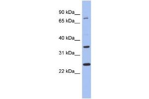 WB Suggested Anti-ZNF133 Antibody Titration:  0. (ZNF133 antibody  (N-Term))
