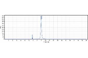 anti-IL1B (Gevokizumab Biosimilar) antibody