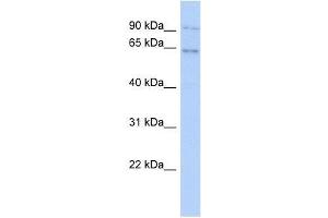 ZNF319 antibody used at 0. (ZNF319 antibody  (N-Term))