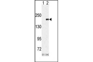 Western blot analysis of EUHMTASE (arrow) using rabbit polyclonal EHMT1 (EUHMTASE1) Antibody (Center) (ABIN387926 and ABIN2844398). (EHMT1 antibody  (AA 979-1010))