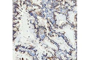 IHC analysis of MUT using anti-MUT antibody (ABIN4886676). (MUT antibody  (N-Term))