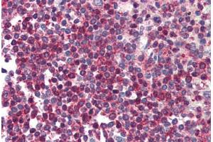 Human Spleen (formalin-fixed, paraffin-embedded) stained with HTRA2 antibody ABIN214496 at 5 ug/ml followed by biotinylated goat anti-rabbit IgG secondary antibody ABIN481713, alkaline phosphatase-streptavidin and chromogen. (HTRA2 antibody  (C-Term))