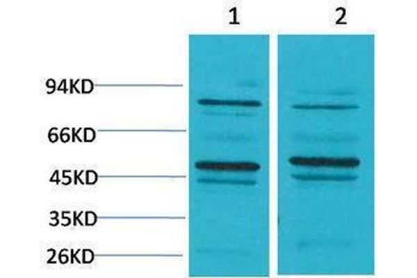 Bestrophin 2 antibody