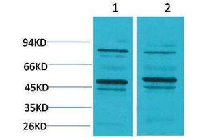 Western Blotting (WB) image for anti-Bestrophin 2 (BEST2) antibody (ABIN3181534)