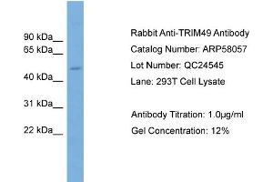 WB Suggested Anti-TRIM49  Antibody Titration: 0. (TRIM49 antibody  (Middle Region))