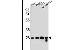 CHPT1 antibody  (N-Term)