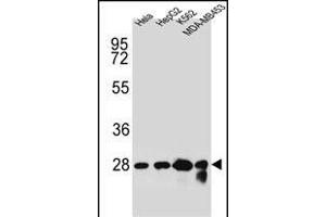 CHPT1 Antibody (N-term) (ABIN654145 and ABIN2844012) western blot analysis in Hela,HepG2,K562,MDA-M cell line lysates (35 μg/lane).