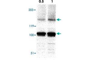 Western blot analysis of IKBKAP in A-20 cell lysate with IKBKAP polyclonal antibody  at in 0. (IKAP/p150 antibody  (C-Term))