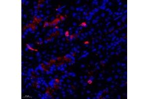 Immunofluorescent analysis of paraformaldehyde-fixed mouse stomach using SYTL2 (ABIN7075797) at dilution of 1: 1200 (SYTL2 antibody)
