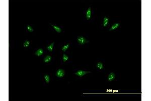Immunofluorescence of purified MaxPab antibody to XAGE2 on HeLa cell. (XAGE2 antibody  (AA 1-111))