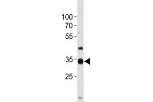 NKX3. (NKX3-2 antibody  (AA 3-2))