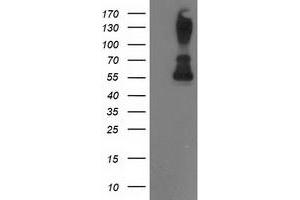 Western Blotting (WB) image for anti-Protein Phosphatase, Mg2+/Mn2+ Dependent, 1B (PPM1B) antibody (ABIN1500374) (PPM1B antibody)