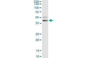 FOXF2 monoclonal antibody (M08), clone 3D11. (FOXF2 antibody  (AA 346-443))