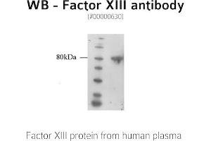 Image no. 1 for anti-Coagulation Factor XIII, A1 Polypeptide (F13A1) antibody (ABIN347012) (F13A1 antibody)