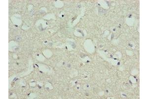 Immunohistochemistry of paraffin-embedded human brain tissue using ABIN7170811 at dilution of 1:100 (STOX1 antibody  (AA 559-858))