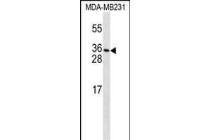 PDGFC Antibody (T89) (ABIN650654 and ABIN2837869) western blot analysis in MDA-M cell line lysates (35 μg/lane). (PDGFC antibody  (N-Term))