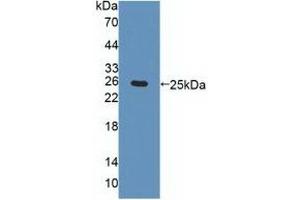 Detection of Recombinant CHRNa4, Human using Polyclonal Antibody to Cholinergic Receptor, Nicotinic, Alpha 4 (CHRNa4) (CHRNA4 antibody  (AA 49-242))
