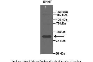 Western Blotting (WB) image for anti-Betaine--Homocysteine S-Methyltransferase (BHMT) (N-Term) antibody (ABIN2773785)