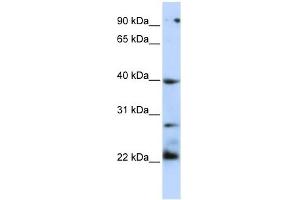 Western Blotting (WB) image for anti-Tumor Necrosis Factor Receptor Superfamily, Member 10b (TNFRSF10B) (N-Term) antibody (ABIN926857)