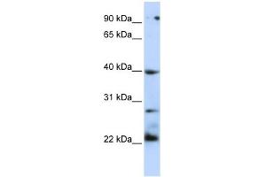TNFRSF10B antibody (70R-10433) used at 0. (TNFRSF10B antibody  (N-Term))