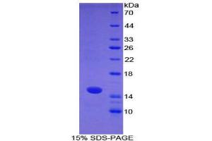SDS-PAGE (SDS) image for S100 Calcium Binding Protein A7 (S100A7) (AA 1-108) protein (His tag) (ABIN2122037)