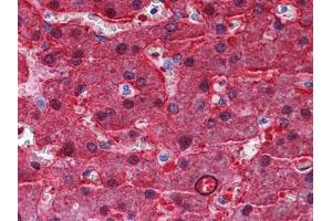 Immunohistochemical analysis of paraffin-embedded human Liver tissues using BHMT antibody (BHMT antibody)