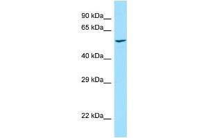 Western Blotting (WB) image for anti-Protein Kinase C Substrate 80K-H (PRKCSH) (N-Term) antibody (ABIN2789691)