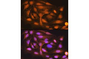 Immunofluorescence analysis of U-2 OS cells using ISG15 Rabbit mAb (ABIN7268023) at dilution of 1:100 (40x lens). (ISG15 antibody)