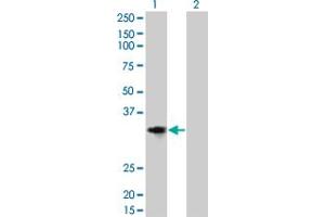 Western Blot analysis of CCND2 expression in transfected 293T cell line by CCND2 monoclonal antibody (M01), clone 3B10. (Cyclin D2 antibody  (AA 190-289))
