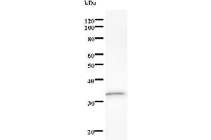 Western Blotting (WB) image for anti-DEAD (Asp-Glu-Ala-Asp) Box Polypeptide 17 (DDX17) antibody (ABIN933152)