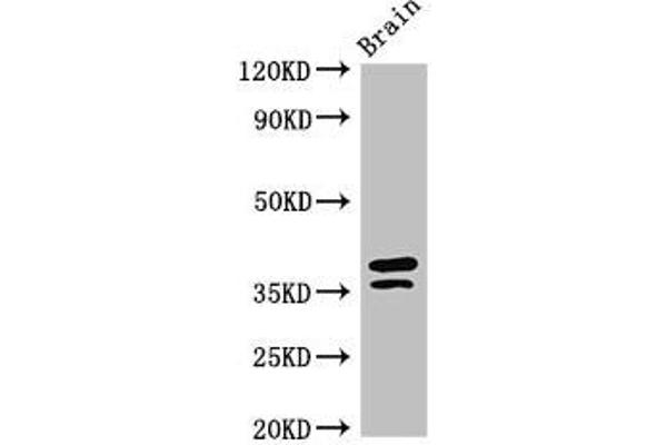 MAPRE2 antibody  (AA 159-240)