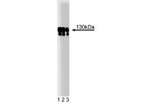 Western blot analysis of p130 [Cas] on a human endothelial cell lysate. (BCAR1 antibody  (AA 644-819))