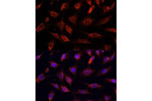 Immunofluorescence analysis of C6 cells using DNL1 antibody (ABIN6130967, ABIN6139736, ABIN6139738 and ABIN6217037) at dilution of 1:100. (DNASEX antibody  (AA 1-302))
