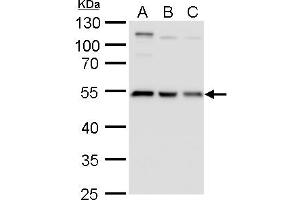 WB Image beta Tubulin 2 antibody detects beta Tubulin 2 protein by western blot analysis. (TUBB2A antibody)