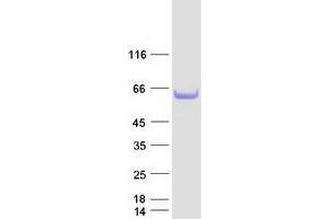 Western Blotting (WB) image for Stromal Membrane Associated Protein 1 (SMAP1) (Transcript Variant 2) protein (Myc-DYKDDDDK Tag) (ABIN2732232)