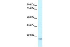 Image no. 1 for anti-Ubiquitin-Conjugating Enzyme E2 Variant 1 (UBE2V1) (C-Term) antibody (ABIN6747633) (UBE2V1 antibody  (C-Term))
