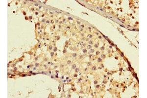 Immunohistochemistry of paraffin-embedded human testis tissue using ABIN7172144 at dilution of 1:100 (THADA antibody  (AA 432-651))