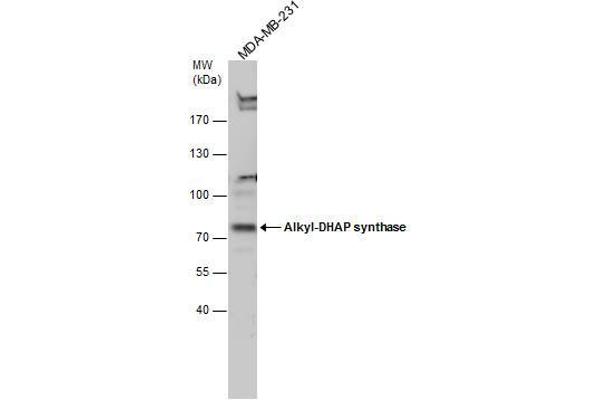AGPS antibody