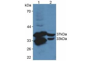 Figure. (CYR61 antibody  (AA 176-379))