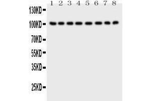 Western Blotting (WB) image for anti-Membrane Metallo-Endopeptidase (MME) (AA 52-750) antibody (ABIN3043879) (MME antibody  (AA 52-750))