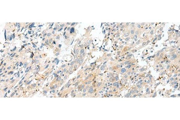 NXNL1 antibody