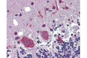 FEZF1 antibody was used for immunohistochemistry at a concentration of 4-8 ug/ml. (FEZF1 antibody  (C-Term))