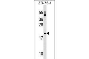 PTRH1 Antibody (Center) (ABIN1537717 and ABIN2849316) western blot analysis in ZR-75-1 cell line lysates (35 μg/lane). (PTRH1 antibody  (AA 102-129))