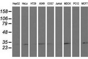Western blot analysis of extracts (35 µg) from 9 different cell lines by using anti-RASD2 monoclonal antibody. (RASD2 antibody)