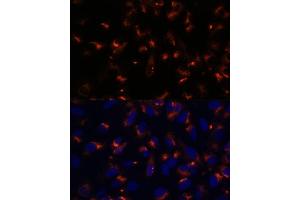 Immunofluorescence analysis of U-2 OS cells using CCDC47 antibody (ABIN7266438) at dilution of 1:100.
