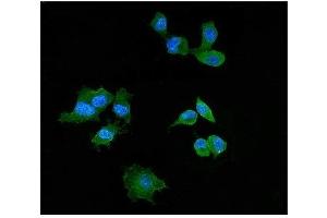 IF analysis of Elafin/Skalp using antiElafin/Skalp antibody (ABIN4886694). (PI3 antibody  (AA 61-117))