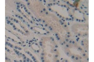 Detection of DKK1 in Human Kidney Tissue using Monoclonal Antibody to Dickkopf Related Protein 1 (DKK1) (DKK1 antibody  (AA 33-266))