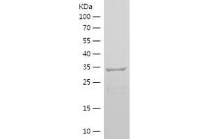 Nestin Protein (NES) (AA 1036-1253) (His tag)