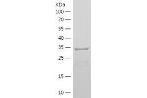 Western Blotting (WB) image for Nestin (NES) (AA 1036-1253) protein (His tag) (ABIN7282702) (Nestin Protein (NES) (AA 1036-1253) (His tag))
