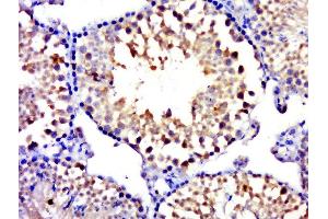 MYCBPAP antibody  (AA 401-500)